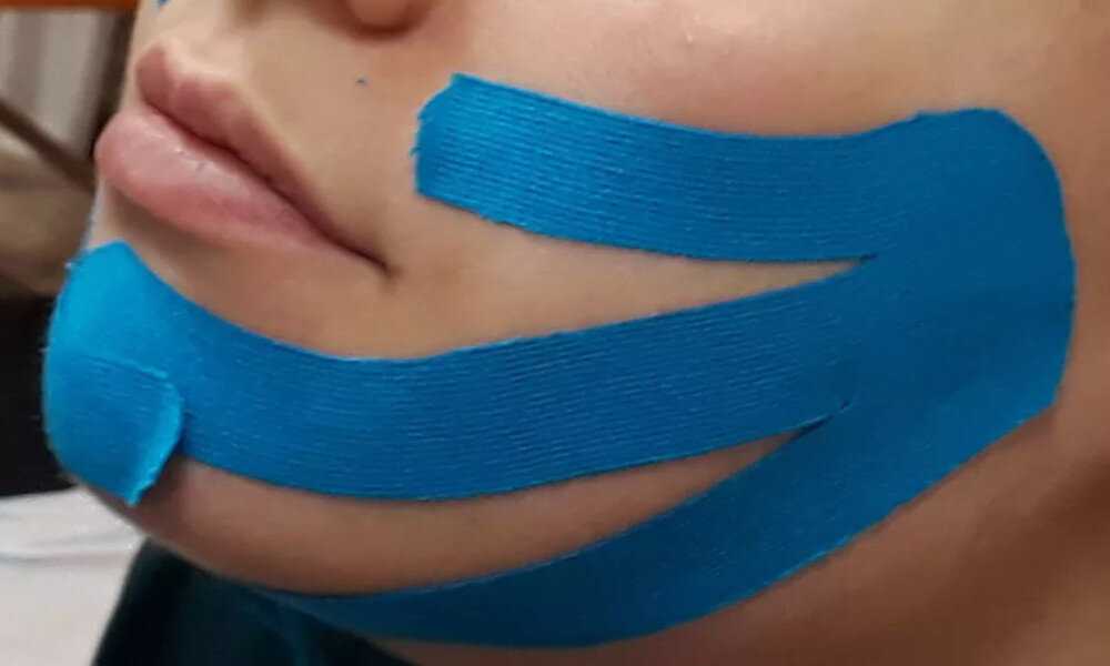 «логопедическое тейпирование в системе комплексной коррекционной работы по преодолению речевых нарушений» (144 ч.) - онлайн-курс от надпо