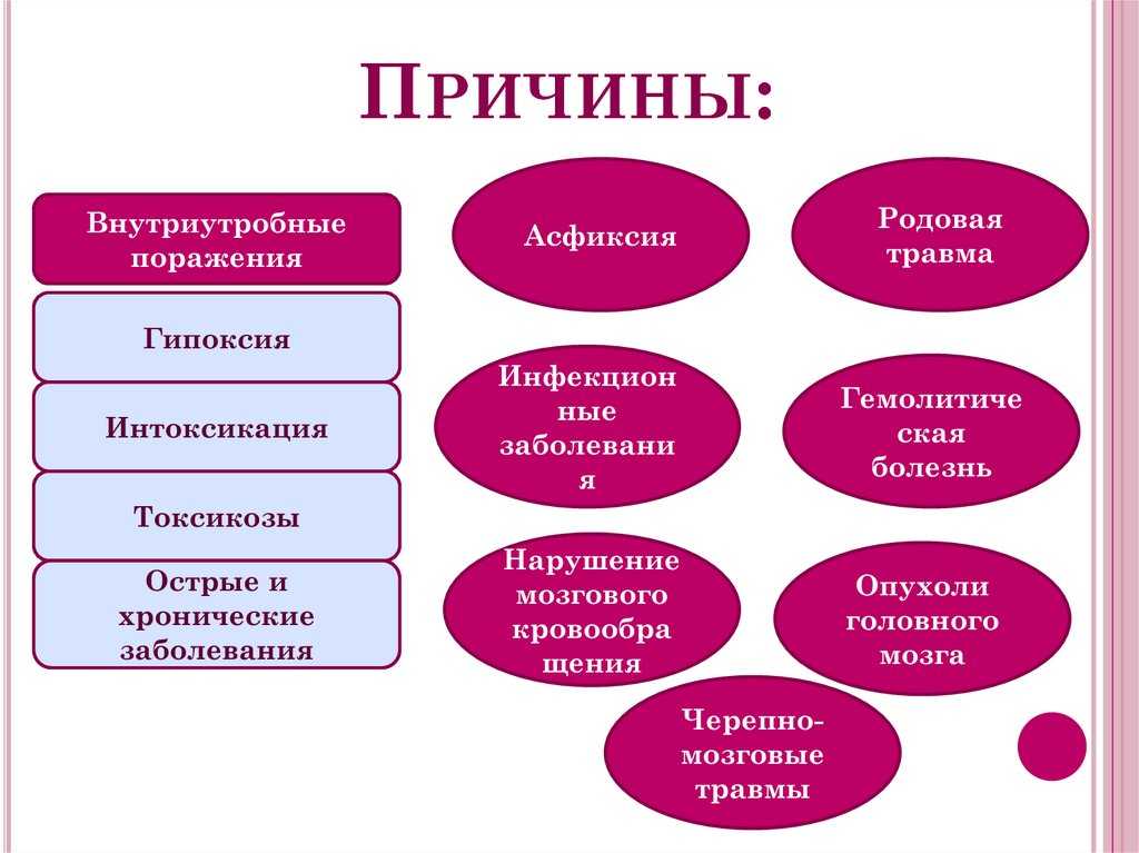Дизартрия