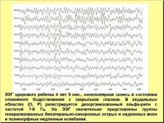 Школа ит новорожденных: публикации - отчет о клинической апробации  монитора церебральной оксиметрии  «fore sight mc» (casmed, сша)