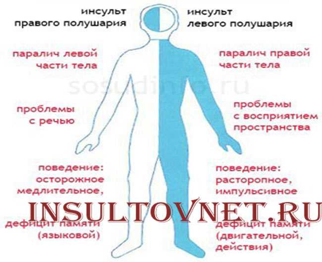 Восстановительное обучение при поражении недоминантного полушария мозга. выдержки из протоколов | статья в журнале «молодой ученый»