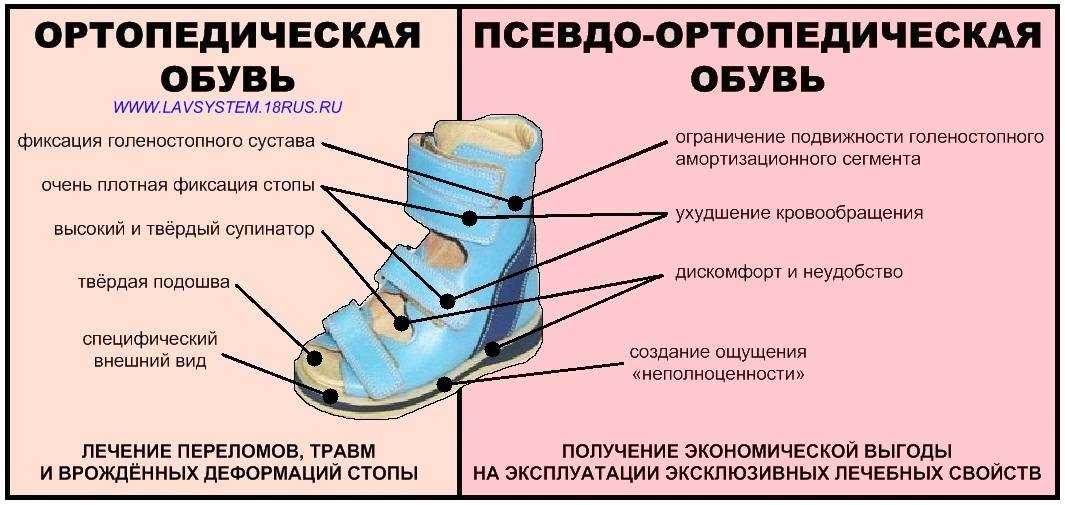 Плоскостопие у детей: степени, типы, причины, симптомы, профилактика, коррекция, лечение в клинике константа в ярославле