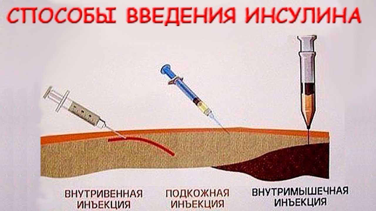 Мягкий знак в глаголах русского языка | училка.io