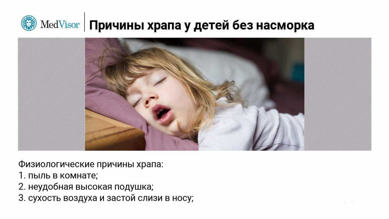 Когда ребенок храпит или детское апноэ сна | симптомы, причины, лечение | лор боклин а. к.