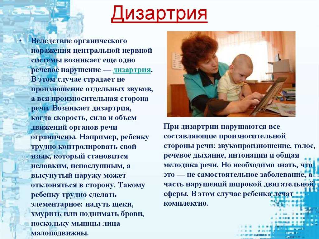 Лечение дизартрии у ребенка — 8 (499) 110-13-71