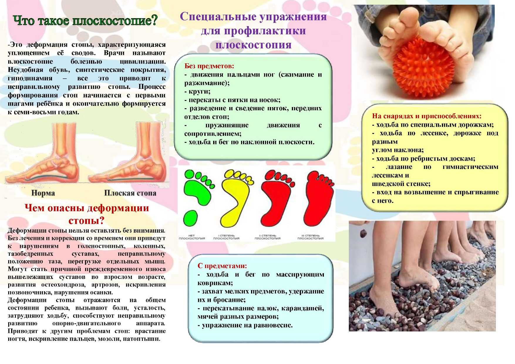 Лечение плоскостопия у детей в домашних условиях