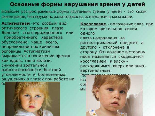 Астигматизм у детей - что это, лечение, как определить симптомы, профилактика