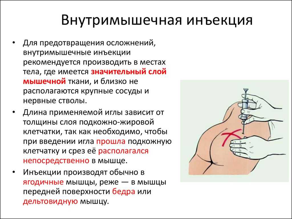 Правописание и объяснение инъекции: все, что нужно знать