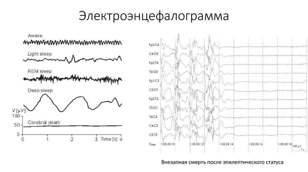 Нейролептики в лечении речевых и поведенческих нарушений у детей