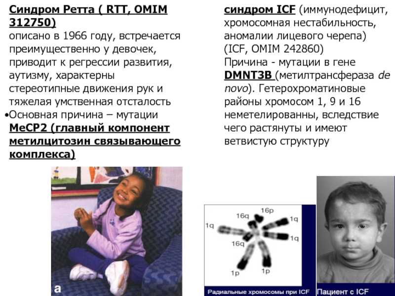 Libr.autism.ru | казанцева л.и., улас в.ю. | синдром ретта у детей