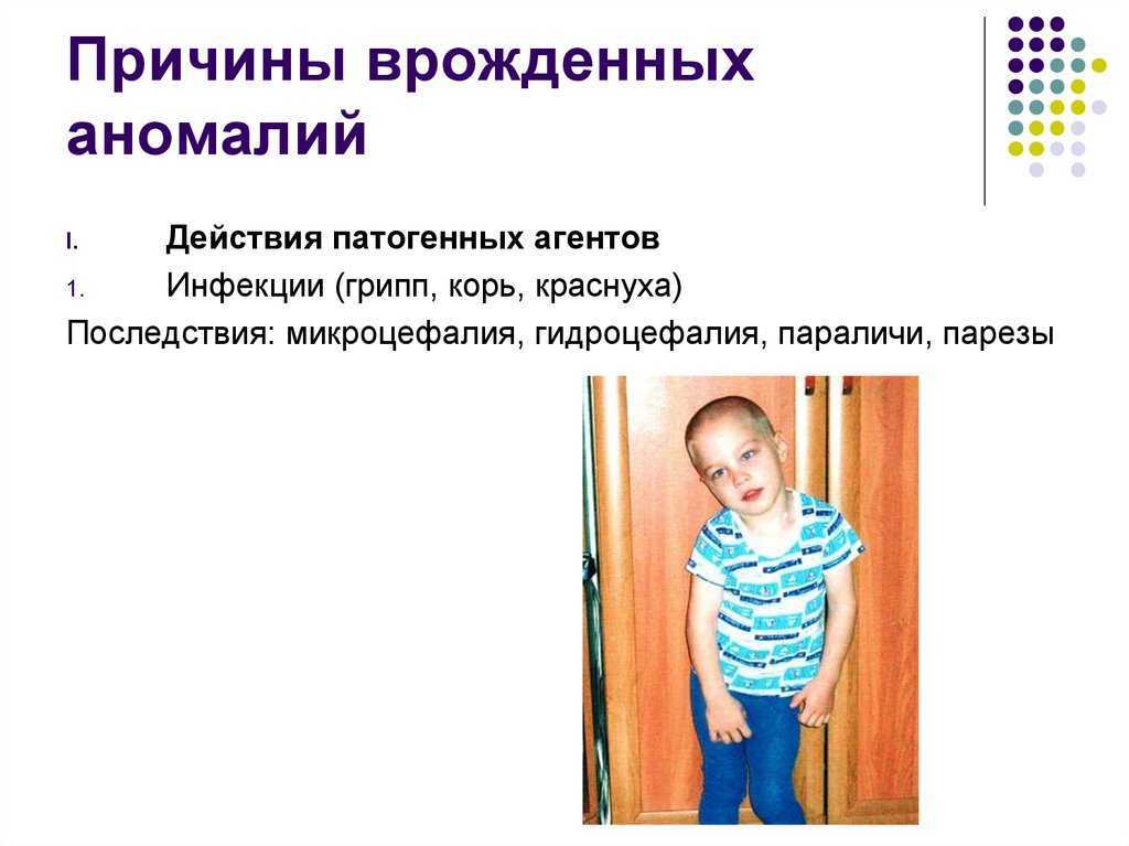 Врожденные пороки развития (повреждение, деформация, синдром)