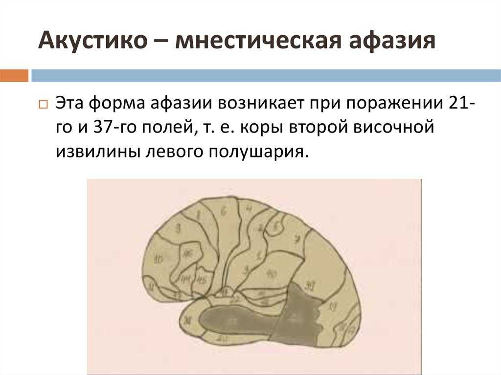 Афазия