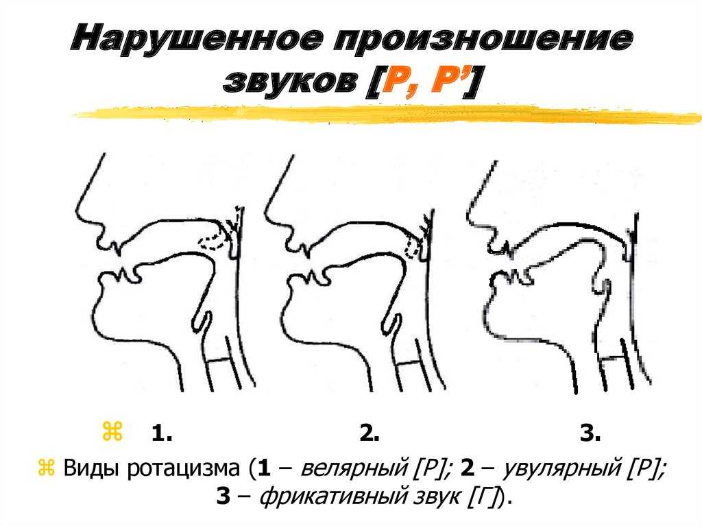 Презентация по логопедии логопедическая характеристика сонорного звука [р],[рь] механизм образования, формы неправильного произношения приемы постановки  доклад, проект