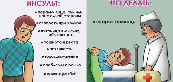 Как восстановить речь после инсульта