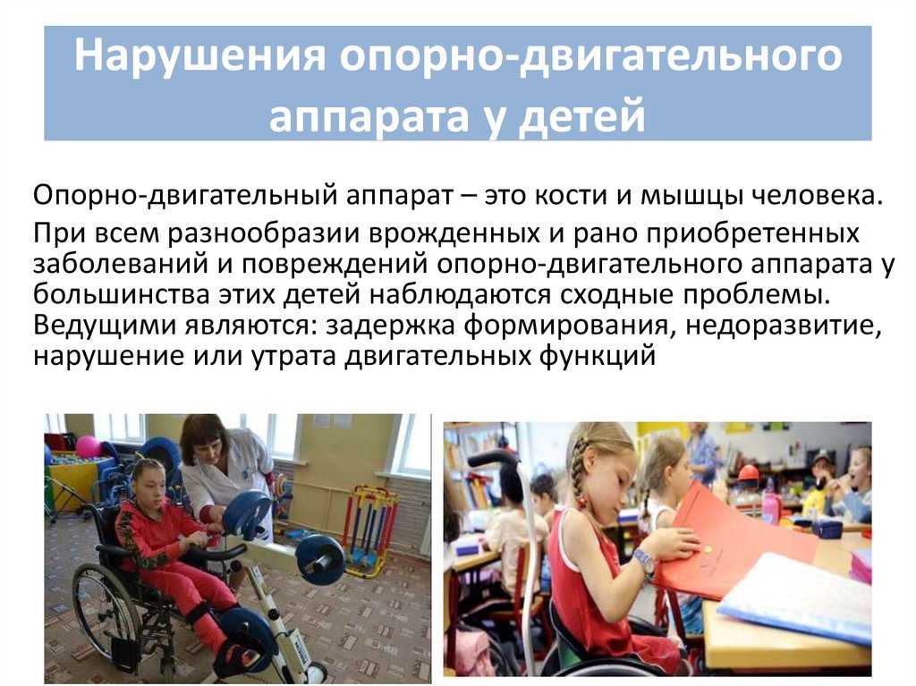 Презентация на тему "технологии коррекционно-развивающей работы с воспитанниками,имеющими нарушения опорно-двигательного аппарата" по педагогике