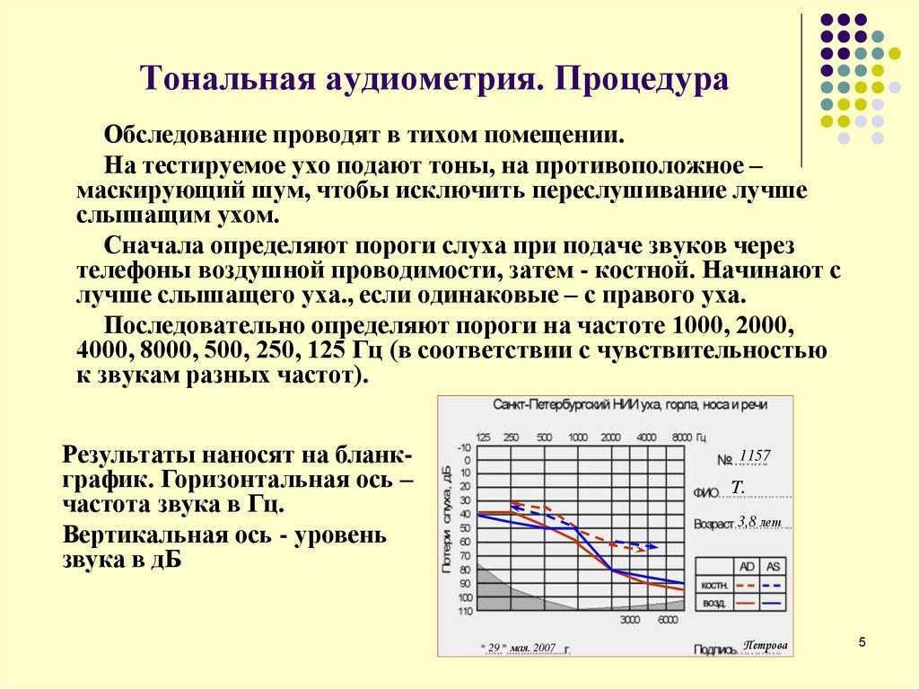 Как проверить слух у новорожденного в домашних условиях
