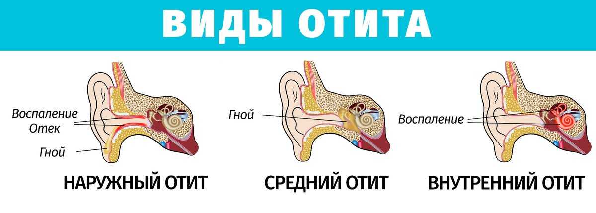 Слух у новорожденного ребенка: слышат ли грудные дети и как это проверить