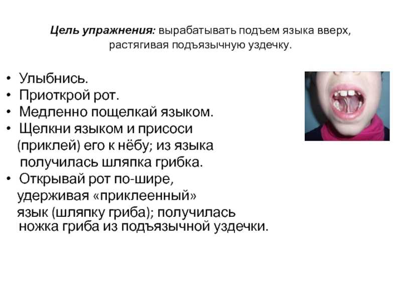 Артикуляционные упражнения для растягивания подъязычной уздечки.  доклад, проект