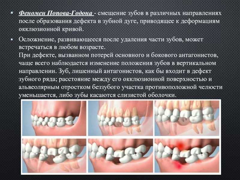 Миогимнастика в ортодонтии, прогнатический прикус - лучшие комплексы упражнений