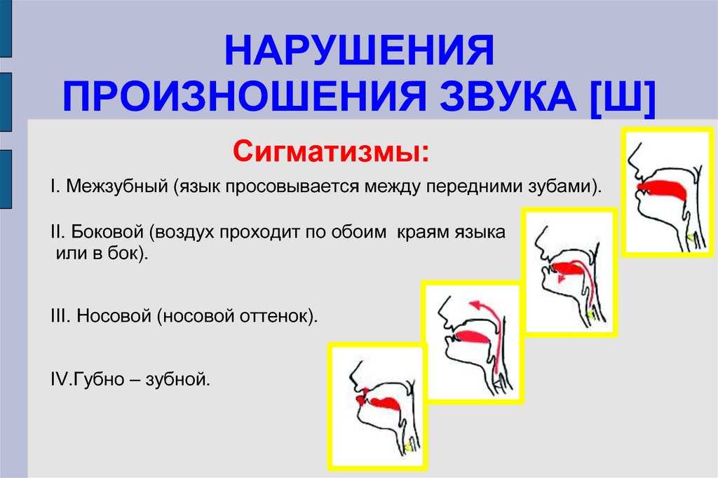 Постанова звуков с, з, ц поэтапно: занятия, упражнения - логопед плюс