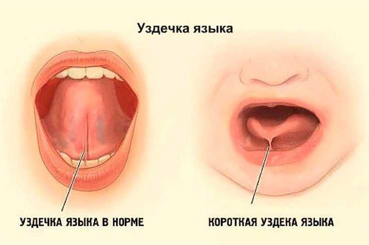 Артикуляционная гимнастика. за советом к логопеду. детский портал солнышко solnet.ee