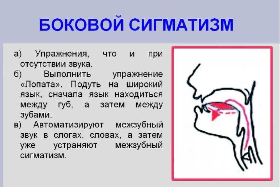 Постановка шипящих звуков «ш щ ч ж» в домашних условиях.