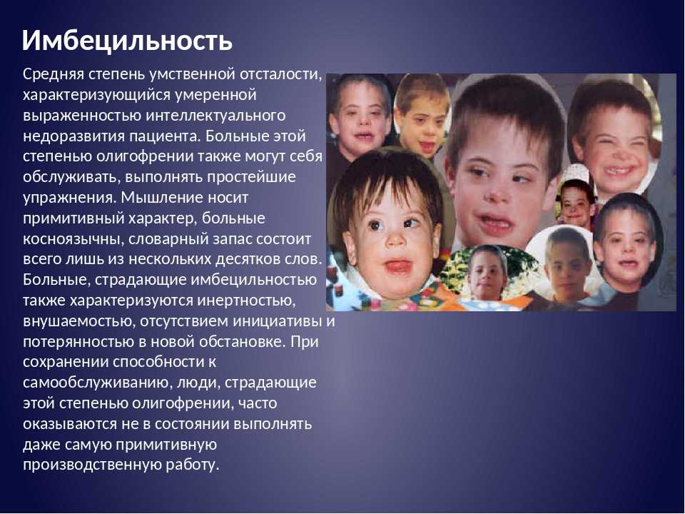 Умственная отсталость (олигофрения) - симптомы и признаки. диагностика и дифференциальная диагностика