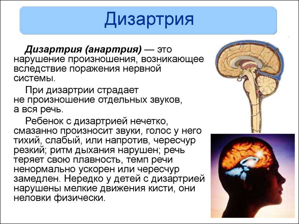Дизартрия - что это? | причины, симптомы и коррекция дизартрии