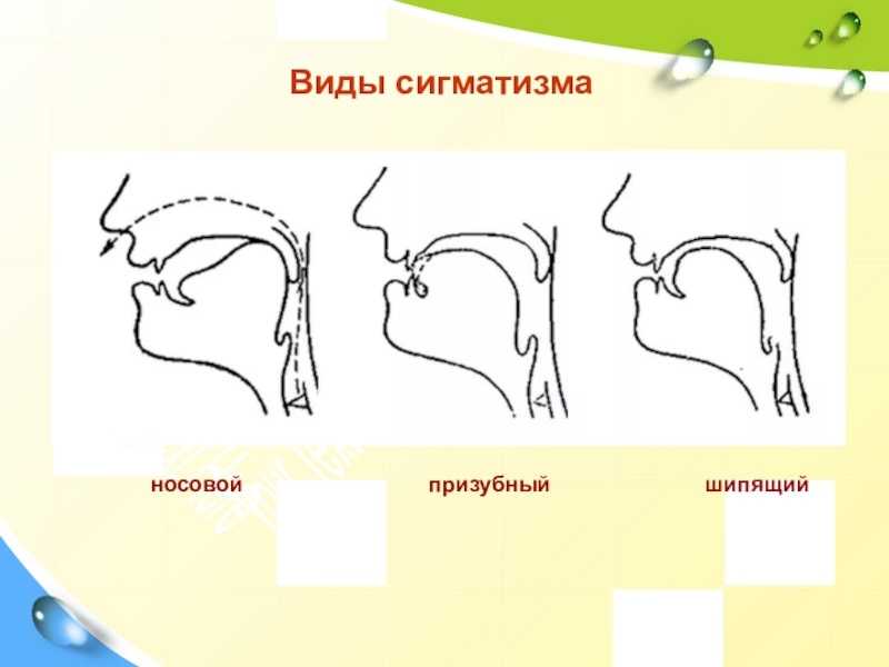 Постановка звука ш – учим правильно говорить