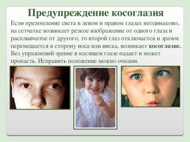 Почему развивается косоглазие у новорожденных и когда оно проходит