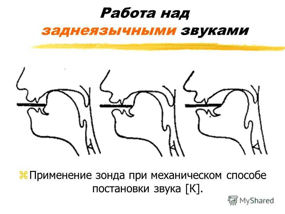 Постановка свистящих звуков Основные этапы