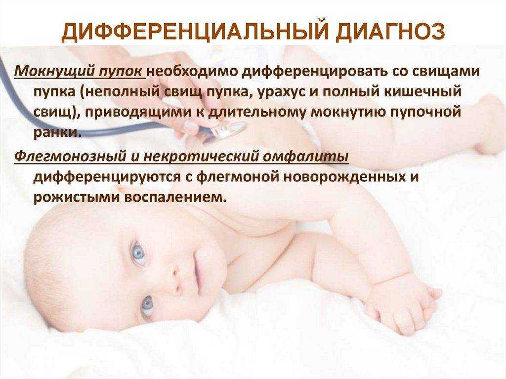 Как ухаживать за пупком новорожденного – heinz baby