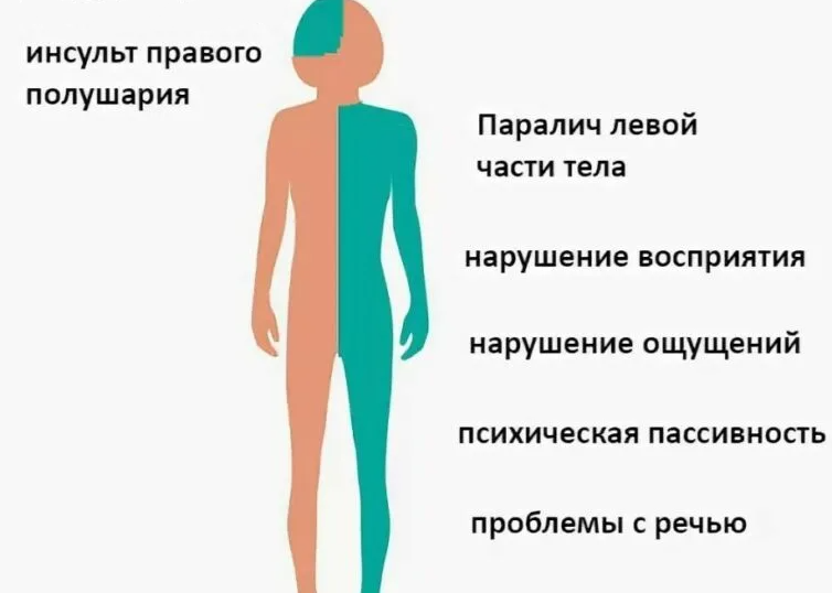 Способы синхронизировать полушария мозга