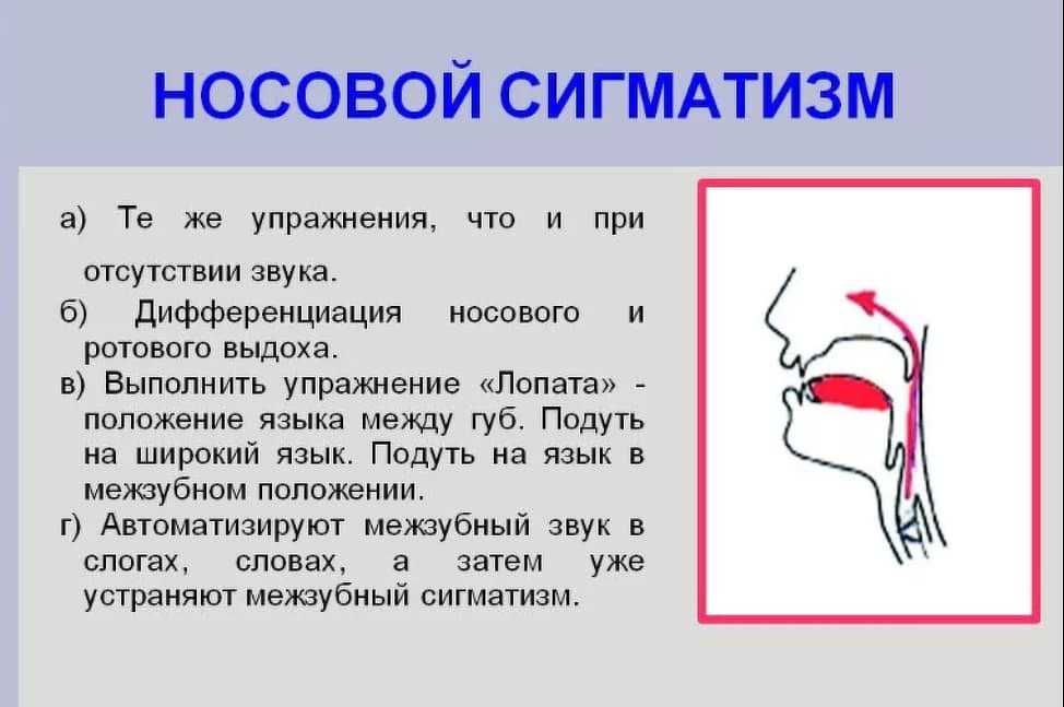 Что такое шипящие звуки?