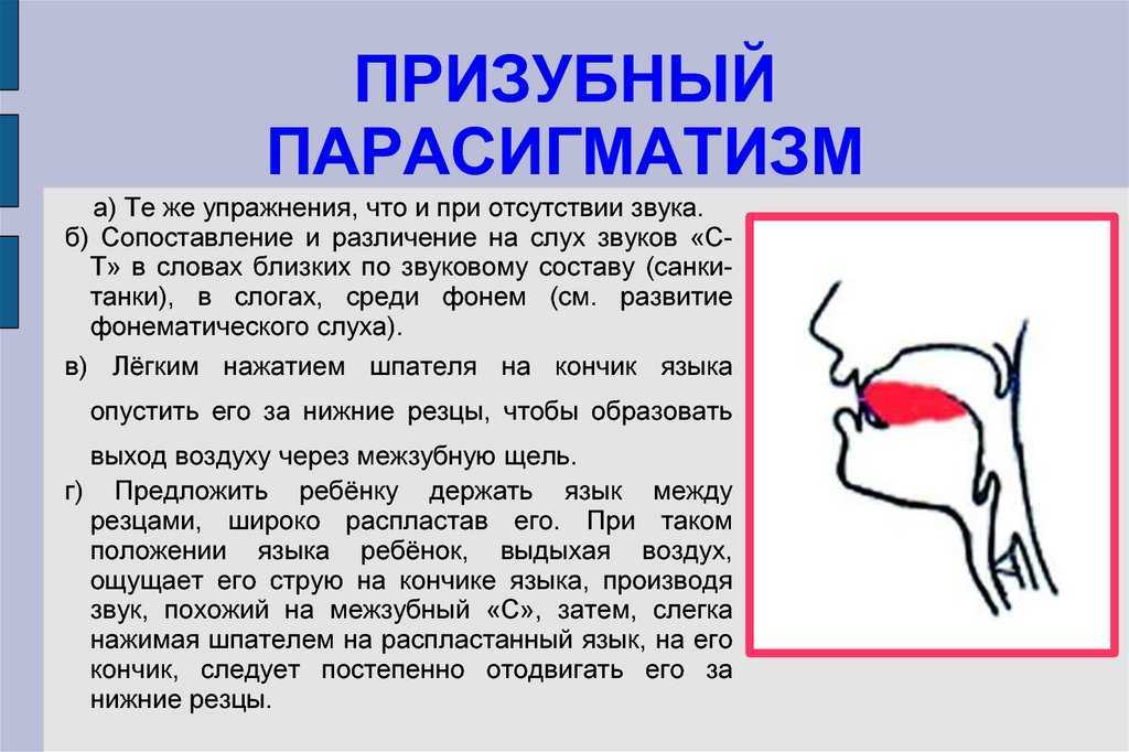 Логопедическая работа по коррекции
сигматизма свистящих звуков
у детей дошкольного возраста | коррекционная работа в доу  | современный урок