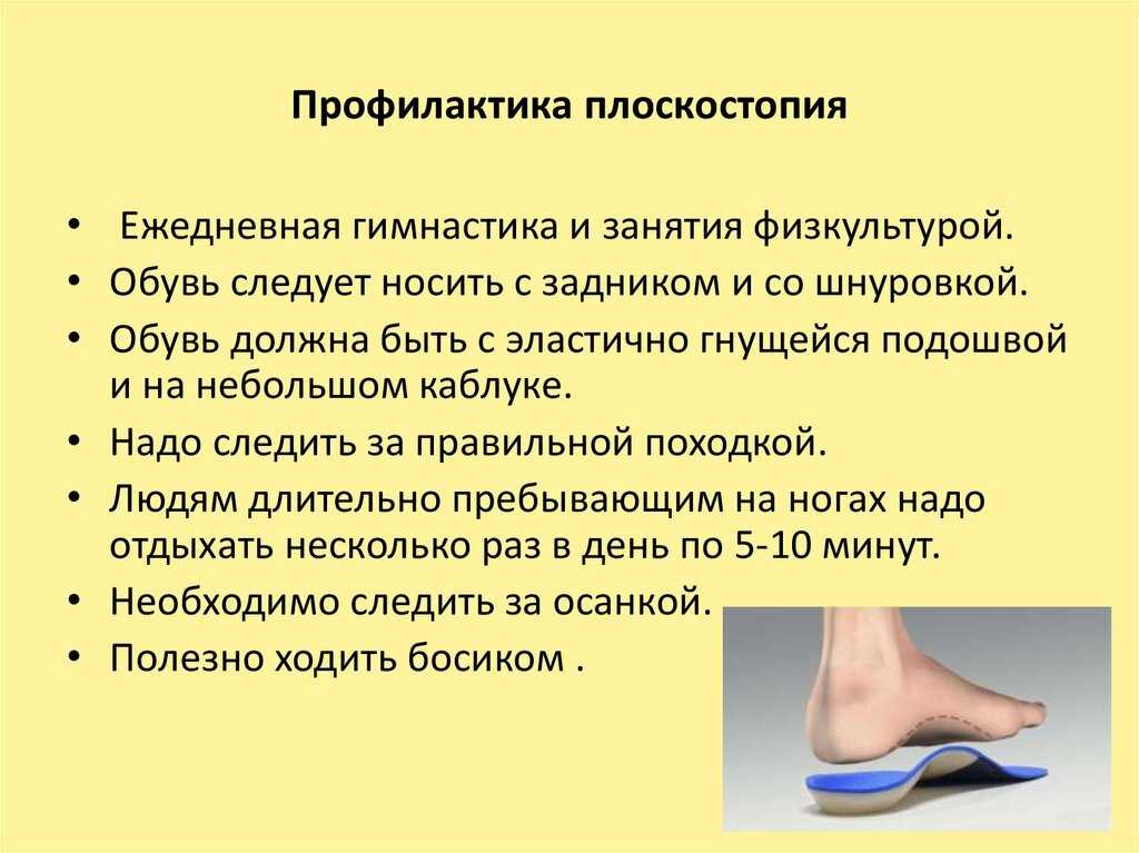 Причины плоскостопия