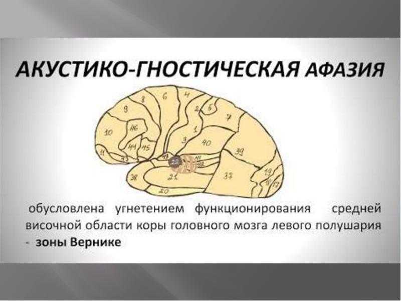 Методичка для логопедов. часть 2. формы афазии и методика восстановления речи