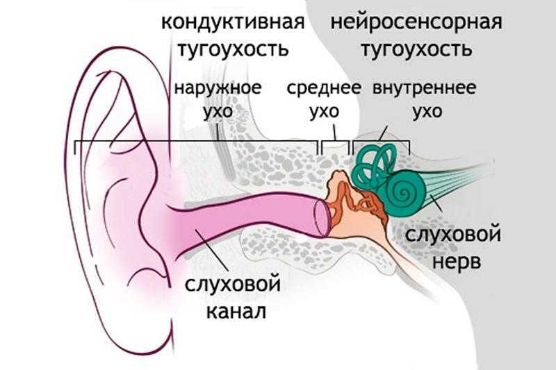 Нарушения слуха у детей: основные причины развития, классификация и способы лечения - medboli.ru