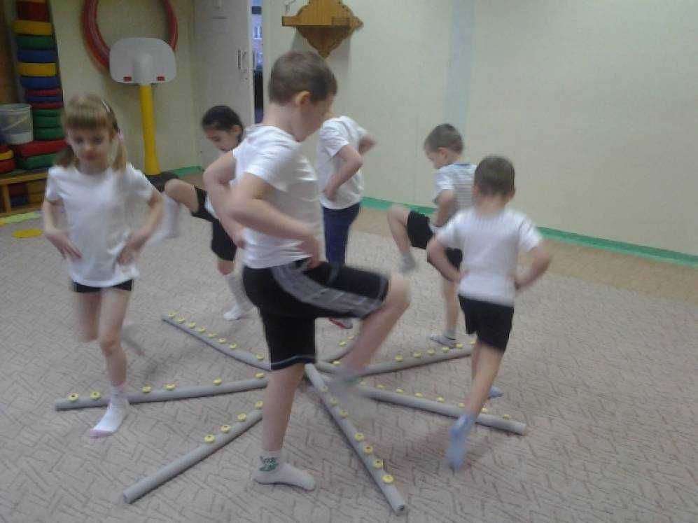 Плоскостопие