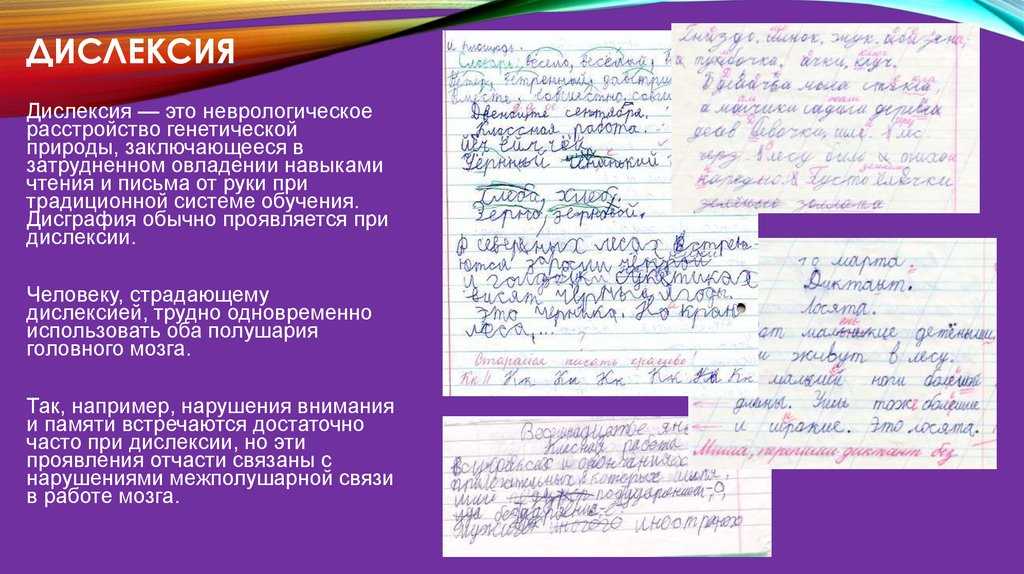 Афазия