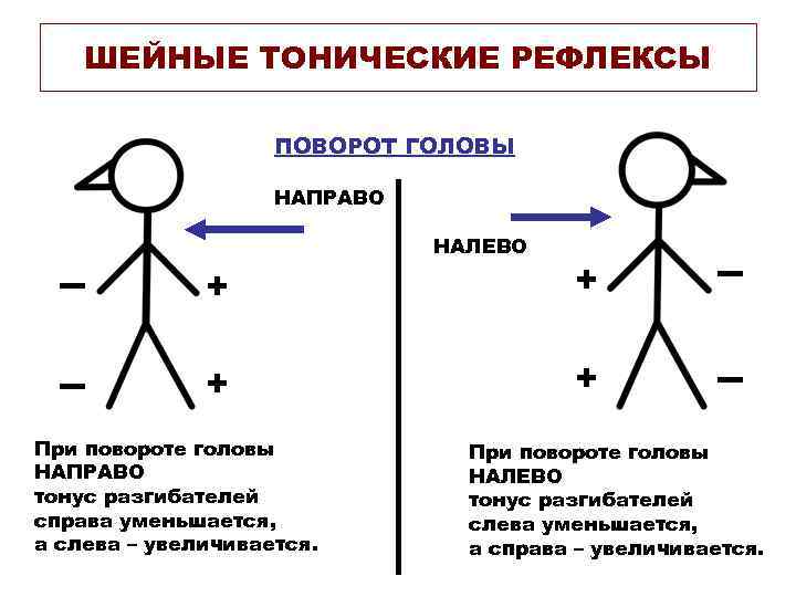 Детский церебральный паралич (дцп) - причины, симптомы, диагностика, лечение