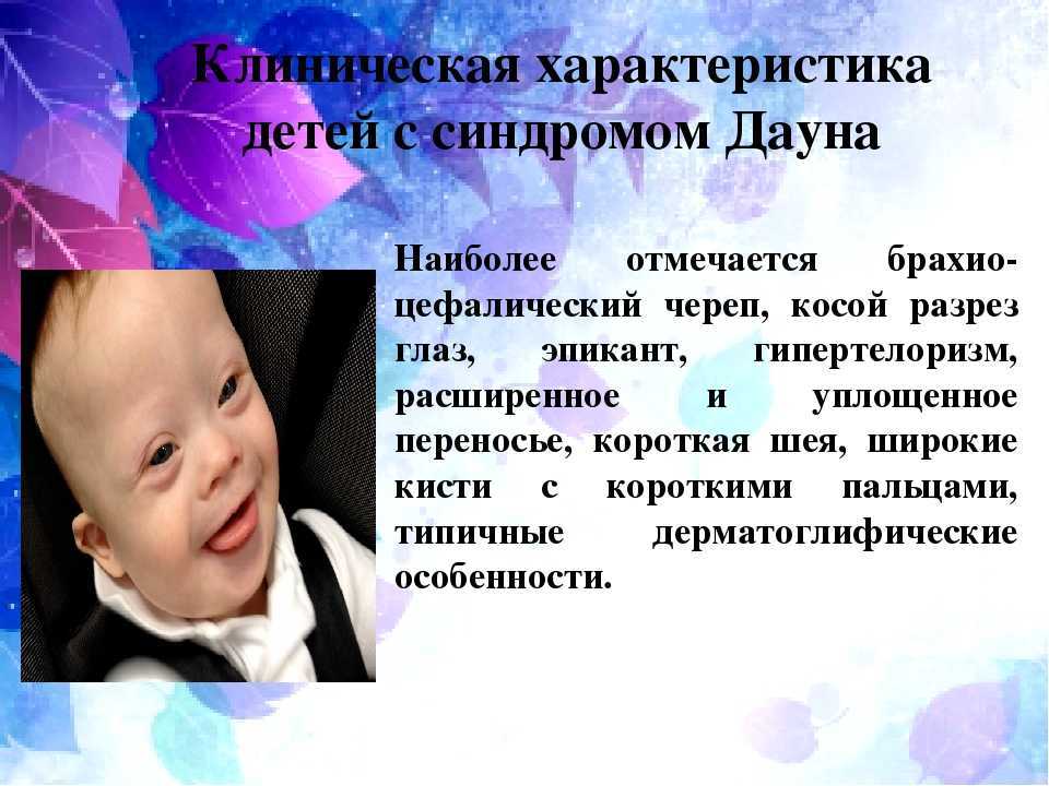 Диагноз «мозаичный синдром дауна»