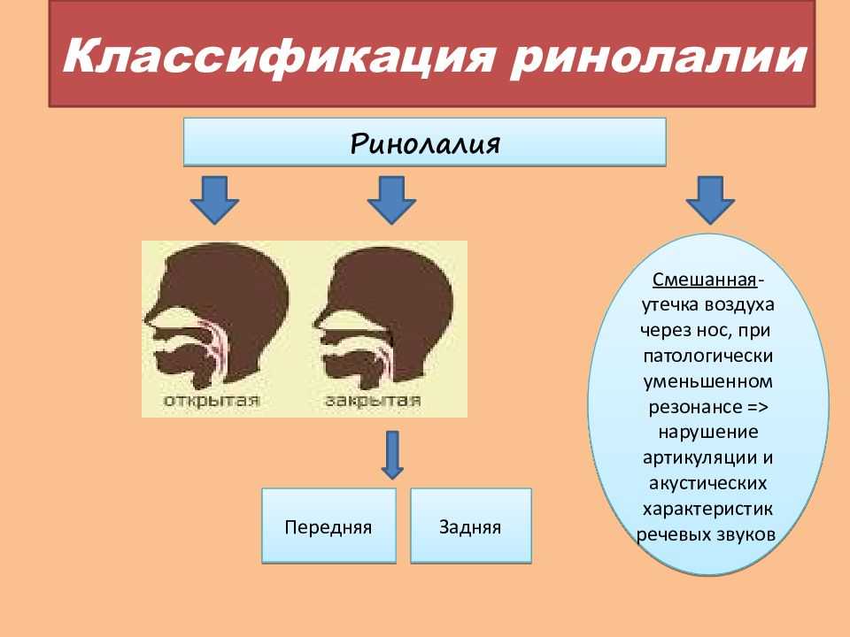 Ринолалия нарушение тембра голоса и звукопроизношения обусловленное анатомо физиологическими дефектами речевого аппарата
