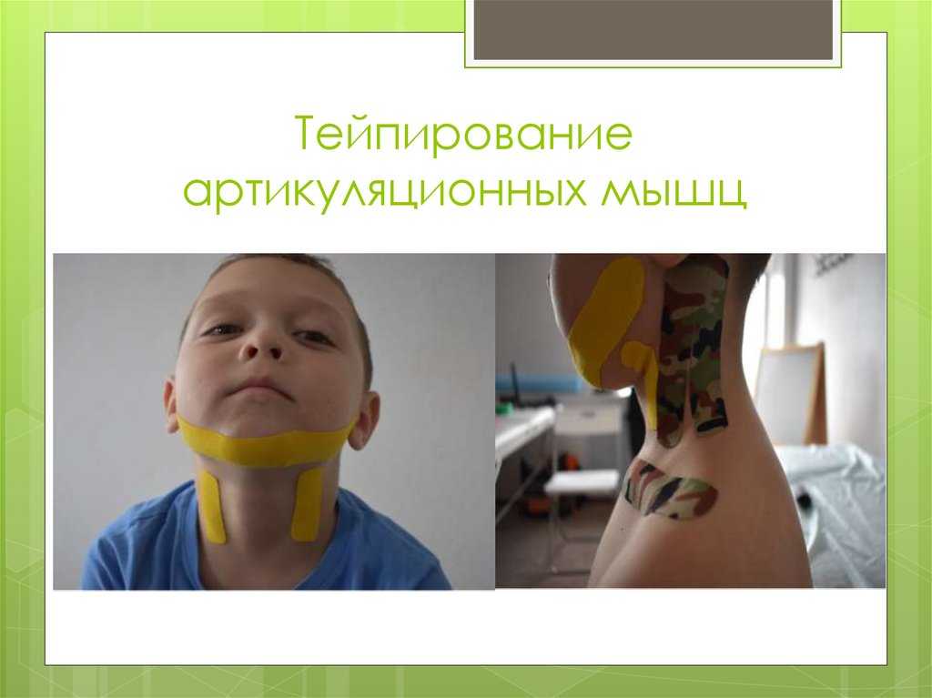 Использование логопедического
кинезиотейпирования в комплексной
коррекционной работе по преодолению
речевых нарушений | коррекционная работа в школе  | современный урок