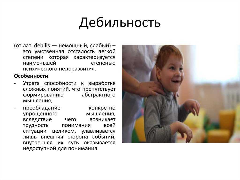 Олигофрения: классификация, клиническая картина, диагностика, лечение