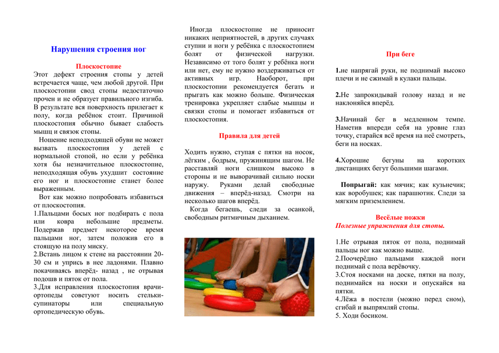 Плоскостопия у детей: причины и профилактика
