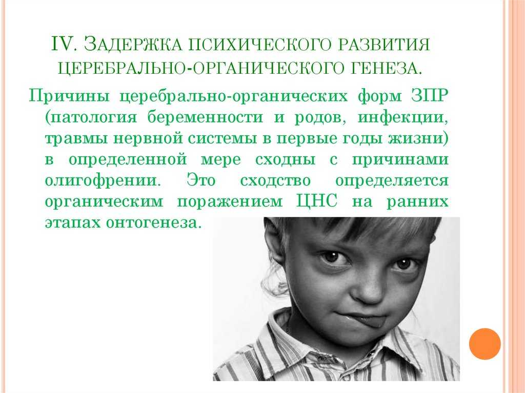 Задержка развития у детей