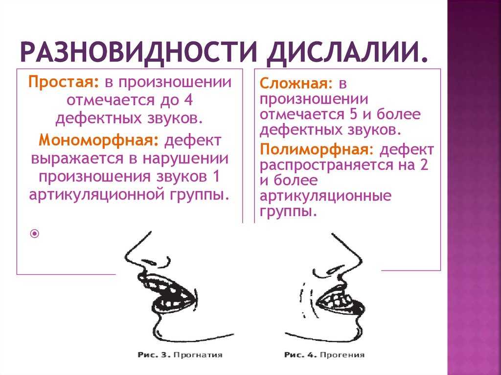 Коррекция фонетической стороны речи у младших школьников в специальной коррекционной школе 7 - реферат