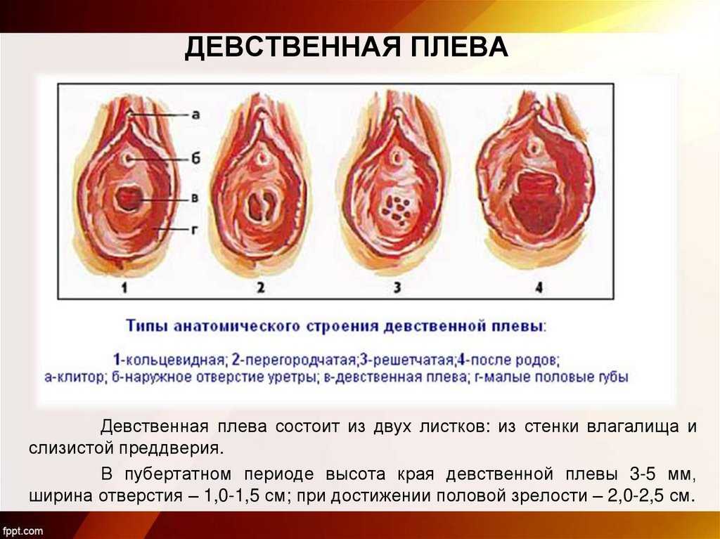 Малые половые губы сильно вылезают, я лишена девственности, если тыкала карандашом