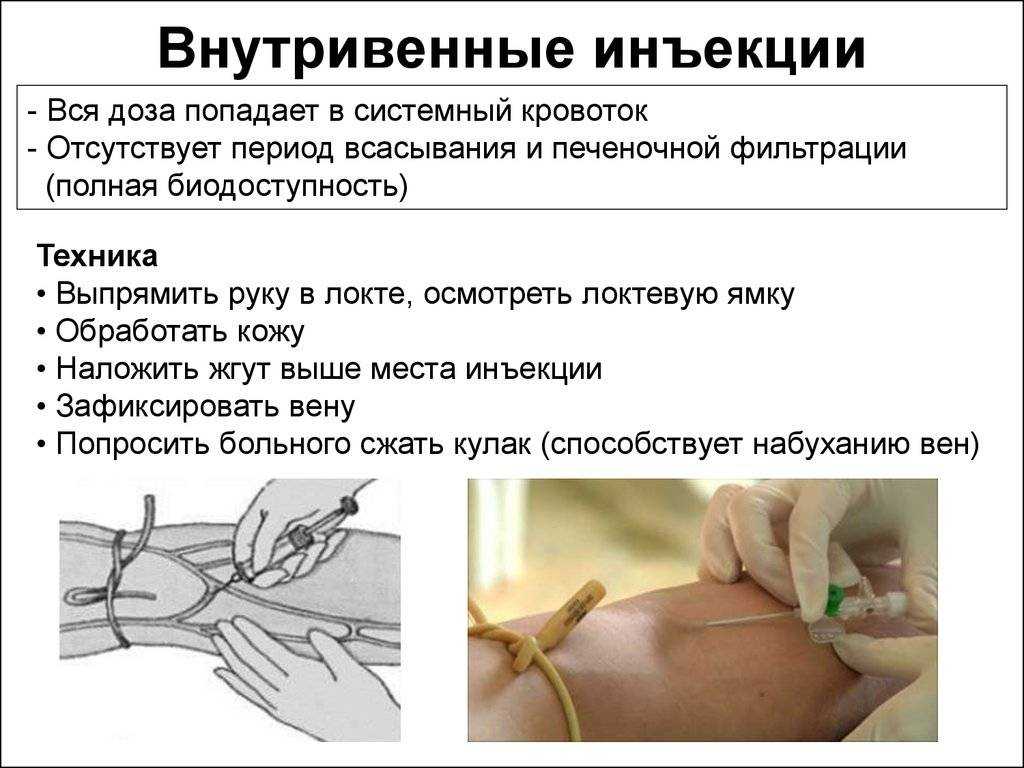 Когда мягкий знак не пишется в словах?