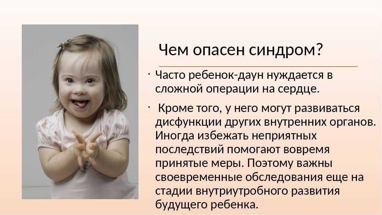 Особенности психофизического
развития ребенка с синдромом дауна | педагогический опыт  | педагогическое мастерство | бесплатные вебинары, публикации педагогов, учителей и воспитателей